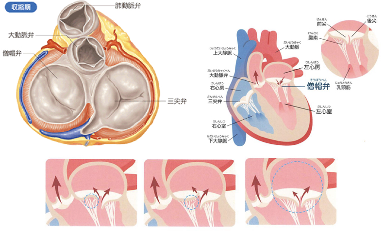 僧帽弁逆流症とは？