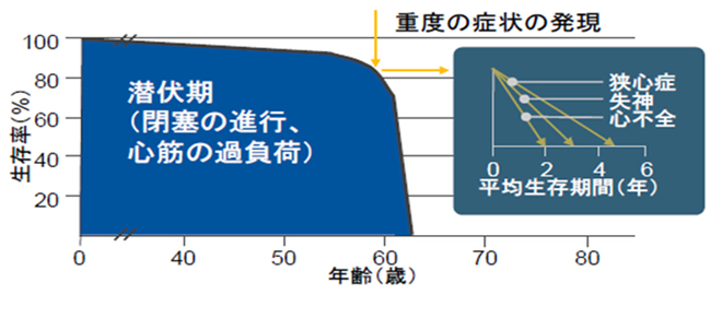 大動脈弁狭窄症とは？